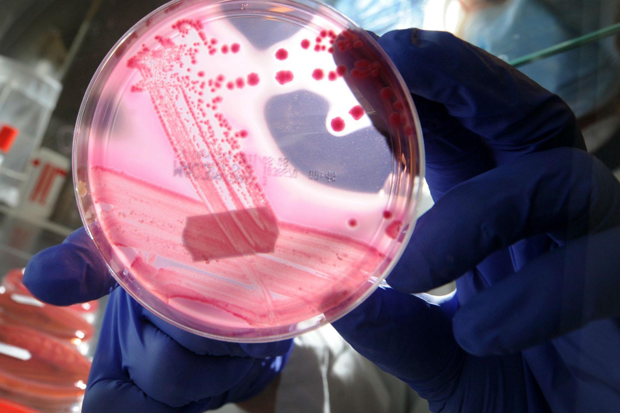 Escherichia coli in hamburger McDonald